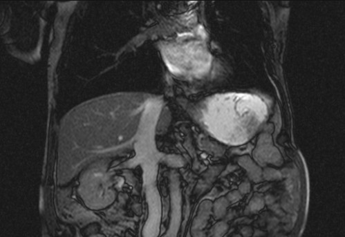 Bildgebung - koronar