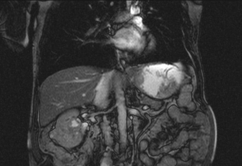 Bildgebung - koronar