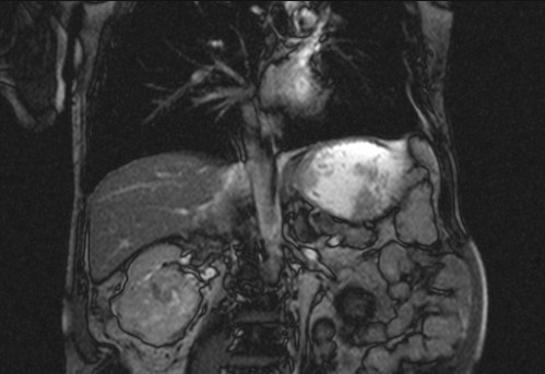 Bildgebung - koronar