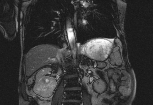 Bildgebung - koronar