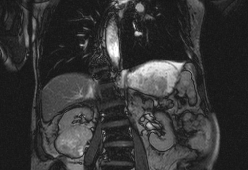Bildgebung - koronar