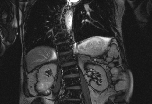 Bildgebung - koronar