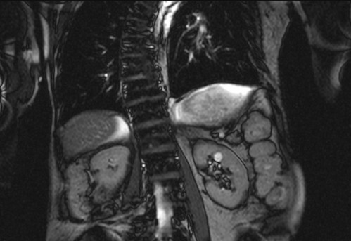 Bildgebung - koronar