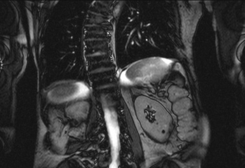 Bildgebung - koronar
