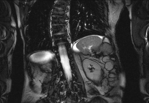 Bildgebung - koronar