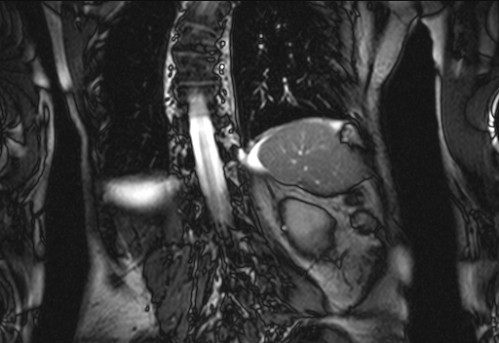 Bildgebung - koronar