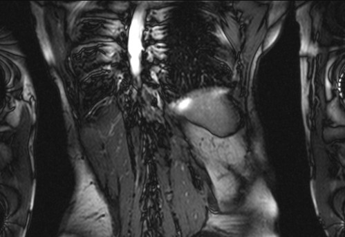 Bildgebung - koronar