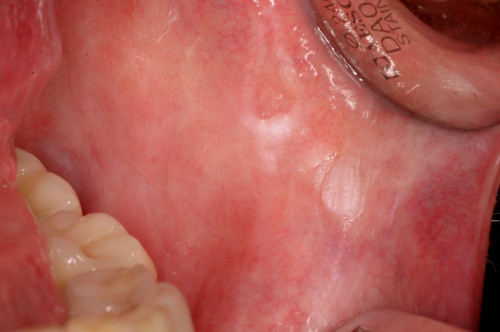 Makroskopie - enoral