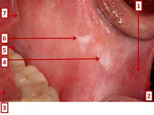 Makroskopie - enoral nummeriert