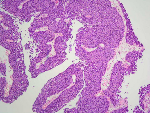 Mikroskopie - Histologiepräparat TUR-B